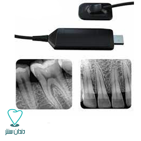 آر وی جی داینامیک سایز 1.5(سنسور دیجیتال داخل دهانی) / Digital Intraoral Sensor Dynamic RVG Size 1.5